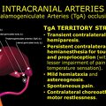 G11.T15.9.VascularDisorders.PosteriorCerebralArtery.Thalamogeniculate arteries occlusion