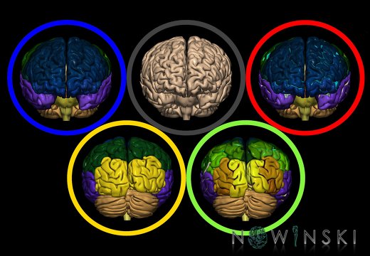 G12.ArtisticBrain.Olympic brain