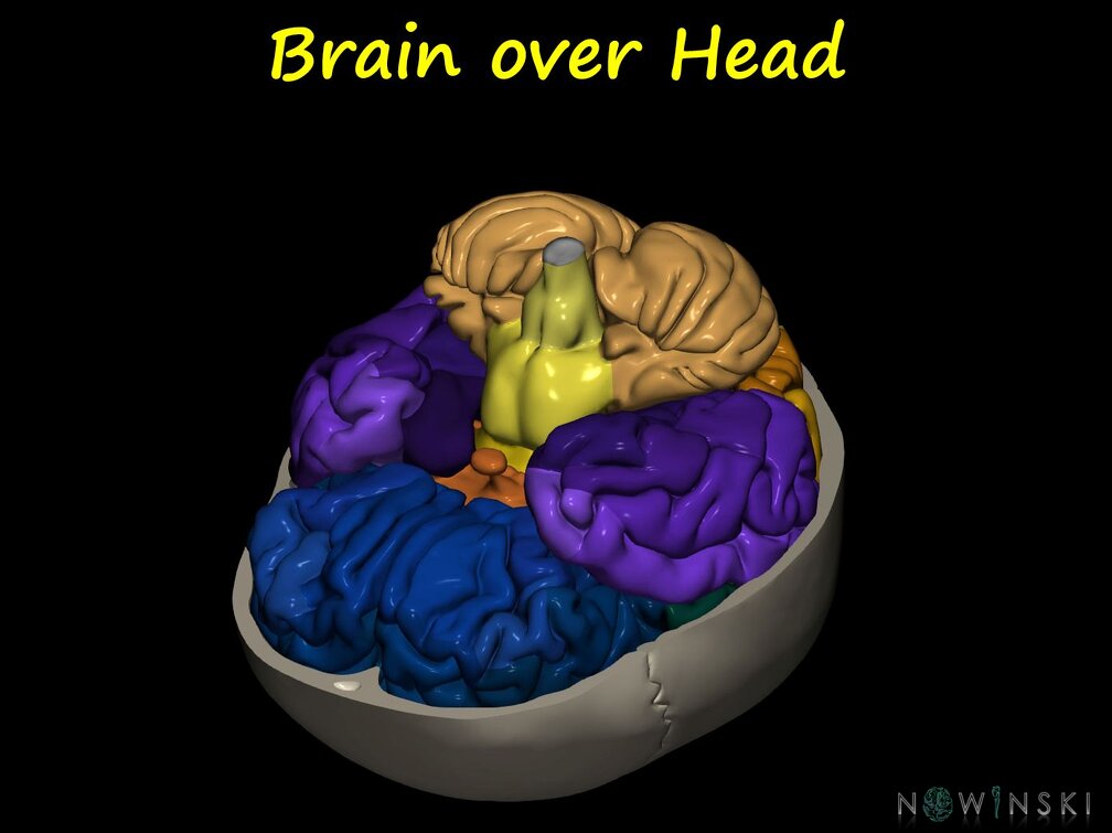 G12.PeaceThroughBrain.Brain over Head