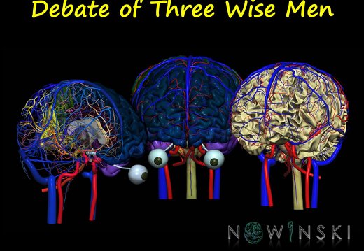 G12.PeaceThroughBrain.Debate of Three Wise Men