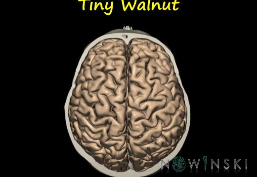 G12.PeaceThroughBrain.Tiny Walnut