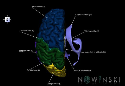 G2.T1.2-12.V5.C2.L1.CNS left–Cerebral ventricles right