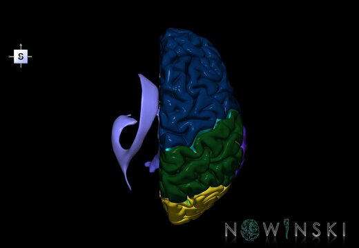 G2T1.3-12.CNSRight-CerebralVentrcilesLeft