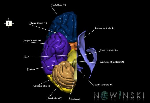 G2.T1.3-12.V6.C2.L1.CNS right–Cerebral ventricles left