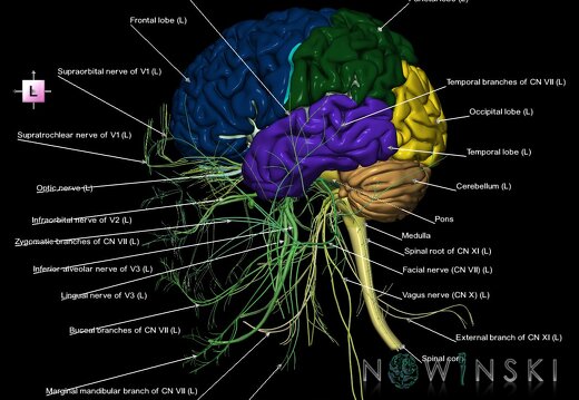 G2.T1.1-19.1.V2.C2.L1.CNS whole–Cranial nerves all