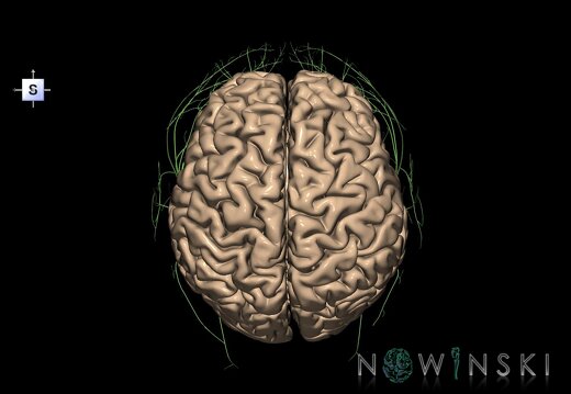 G2.T1.1-19.1.V5.C1.L0.CNS whole–Cranial nerves all