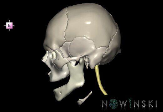G2.T1-22.V2.C2.L0.CNS–Skull