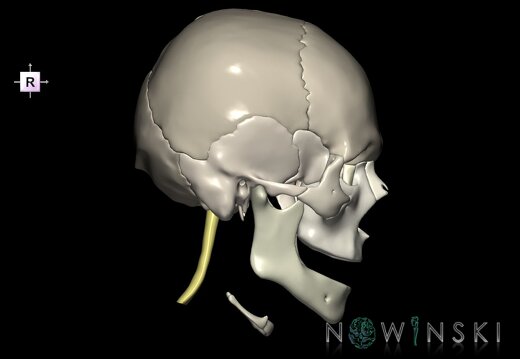 G2.T1-22.V4.C2.L0.CNS–Skull