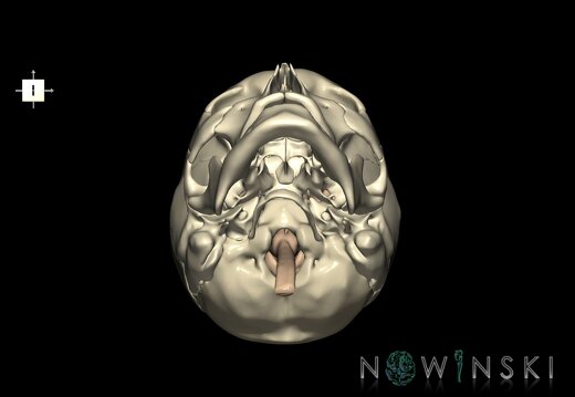 G2.T1-22.V6.C1.L0.CNS–Skull