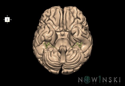 G2.T1-25.V6.C1.L0.CNS–Auditory system