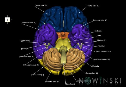 G2.T1-25.V6.C2.L1.CNS–Auditory system