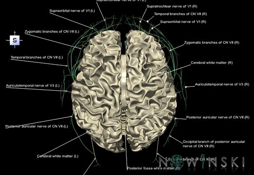 G2.T13.1-19.1.V5.C2.L1.White matter whole–Cranial nerves all