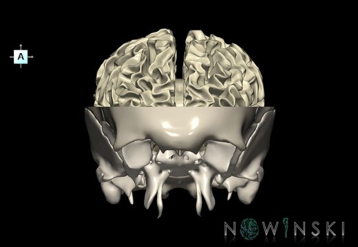 G2.T13.1-22.3.V1.C2.L0.White matter whole–Skull base