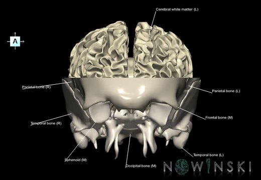 G2.T13.1-22.3.V1.C2.L1.White matter whole–Skull base