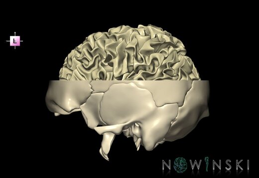 G2.T13.1-22.3.V2.C1.L0.White matter whole–Skull base