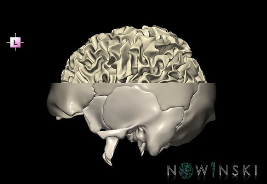 G2.T13.1-22.3.V2.C2.L0.White matter whole–Skull base