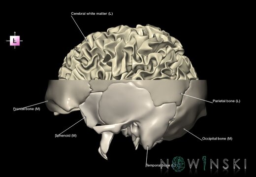 G2.T13.1-22.3.V2.C2.L1.White matter whole–Skull base