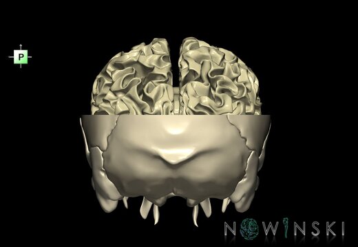 G2.T13.1-22.3.V3.C1.L0.White matter whole–Skull base