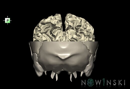 G2.T13.1-22.3.V3.C2.L0.White matter whole–Skull base