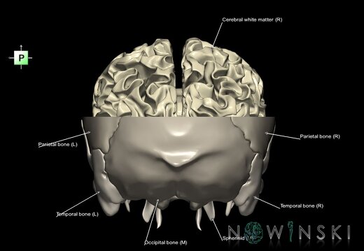 G2.T13.1-22.3.V3.C2.L1.White matter whole–Skull base