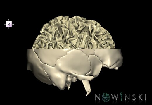 G2.T13.1-22.3.V4.C1.L0.White matter whole–Skull base