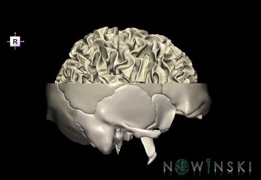 G2.T13.1-22.3.V4.C2.L0.White matter whole–Skull base