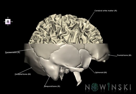 G2.T13.1-22.3.V4.C2.L1.White matter whole–Skull base