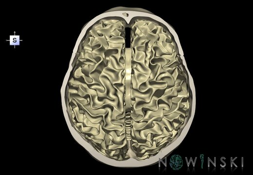 G2.T13.1-22.3.V5.C1.L0.White matter whole–Skull base