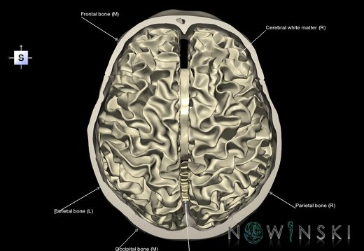 G2.T13.1-22.3.V5.C2.L1.White matter whole–Skull base