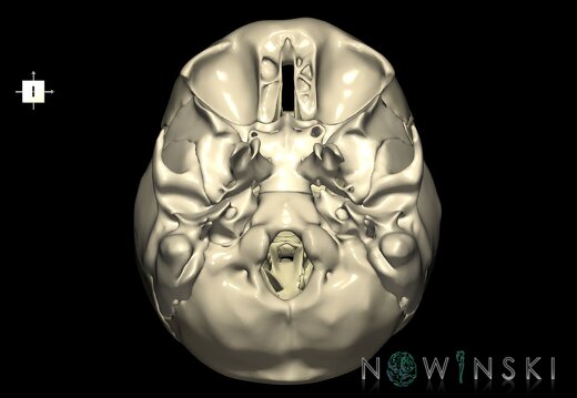 G2.T13.1-22.3.V6.C1.L0.White matter whole–Skull base