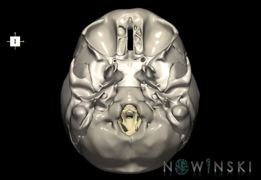G2.T13.1-22.3.V6.C2.L0.White matter whole–Skull base