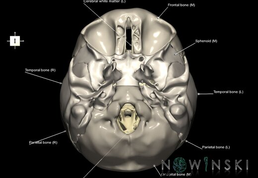 G2.T13.1-22.3.V6.C2.L1.White matter whole–Skull base