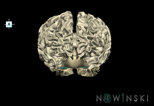 G2.T13.1-25.V1.C2.L0.White matter whole–Auditory system