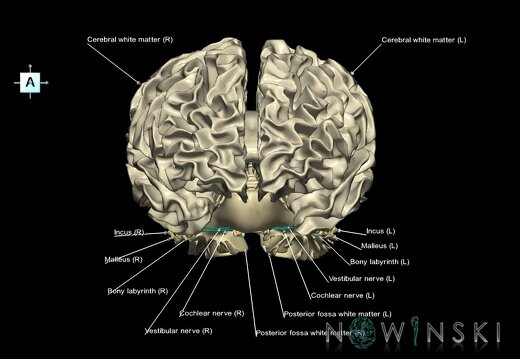 G2.T13.1-25.V1.C2.L1.White matter whole–Auditory system