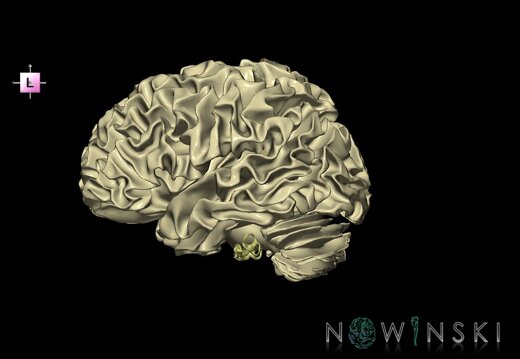 G2.T13.1-25.V2.C1.L0.White matter whole–Auditory system