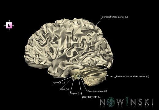 G2.T13.1-25.V2.C2.L1.White matter whole–Auditory system