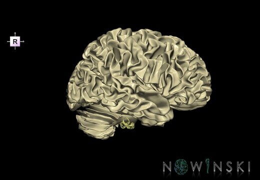 G2.T13.1-25.V4.C1.L0.White matter whole–Auditory system