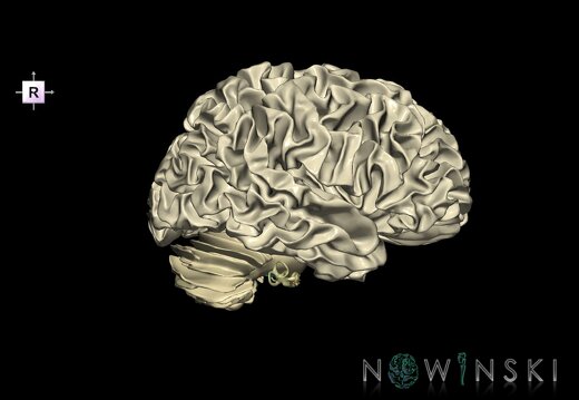 G2.T13.1-25.V4.C2.L0.White matter whole–Auditory system