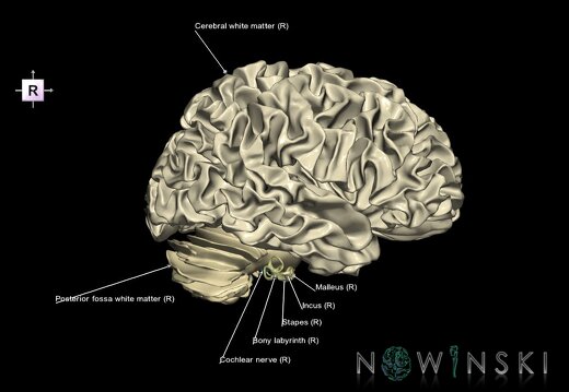 G2.T13.1-25.V4.C2.L1.White matter whole–Auditory system