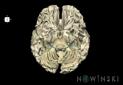G2.T13.1-25.V6.C2.L0.White matter whole–Auditory system