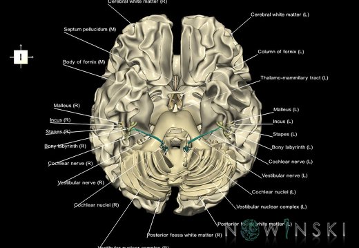 G2.T13.1-25.V6.C2.L1.White matter whole–Auditory system