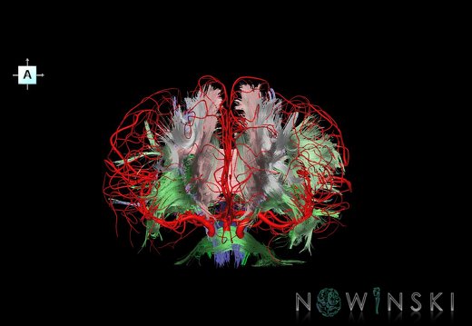 G2.T14.1-15.2.V1.C2-1.L0.White matter tracts all–Intracranial arteries all