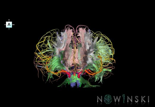G2.T14.1-15.2.V1.C2-2.L0.White matter tracts all–Intracranial arteries all