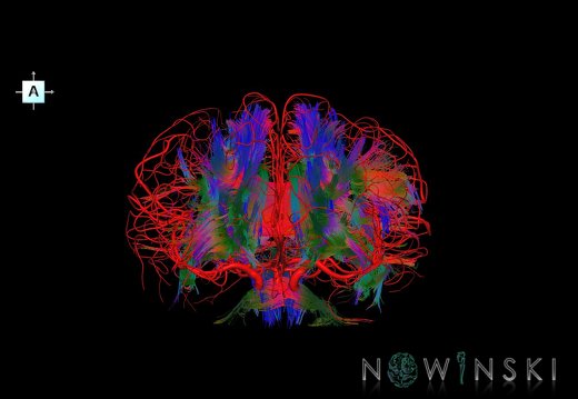 G2.T14.1-15.2.V1.C5-1.L0.White matter tracts all–Intracranial arteries all