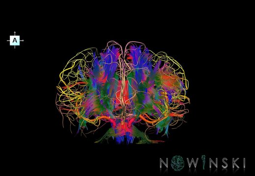 G2.T14.1-15.2.V1.C5-2.L0.White matter tracts all–Intracranial arteries all