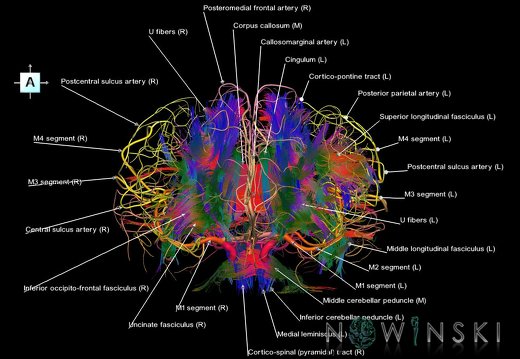 G2.T14.1-15.2.V1.C5-2.L1.White matter tracts all–Intracranial arteries all