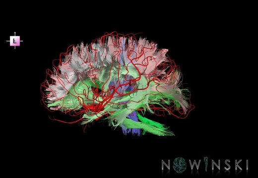 G2.T14.1-15.2.V2.C2-1.L0.White matter tracts all–Intracranial arteries all