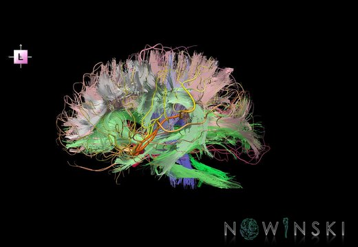 G2.T14.1-15.2.V2.C2-2.L0.White matter tracts all–Intracranial arteries all