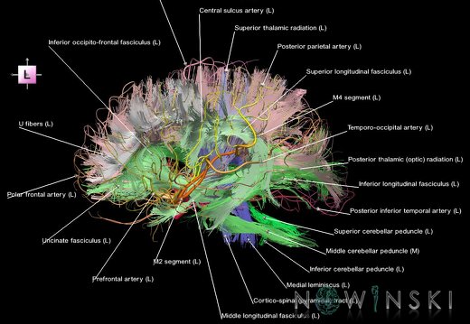 G2.T14.1-15.2.V2.C2-2.L1.White matter tracts all–Intracranial arteries all