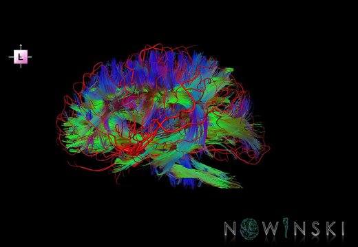 G2.T14.1-15.2.V2.C5-1.L0.White matter tracts all–Intracranial arteries all